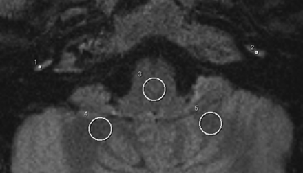 Fig 2.