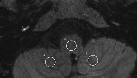 Fig 4.