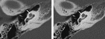 Fig 5.