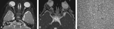 Fig 2.