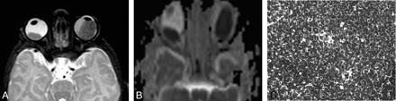 Fig 3.