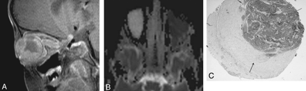 Fig 4.