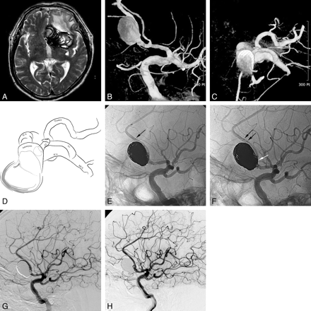 Fig 1.