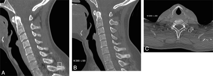 Fig 2.