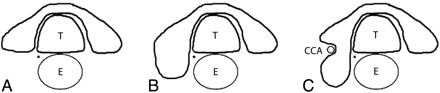 Fig 2.