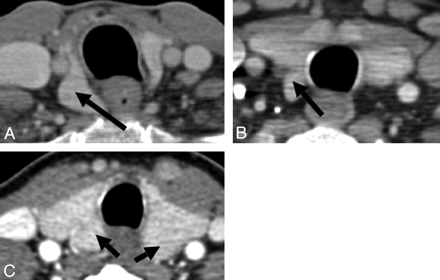Fig 3.