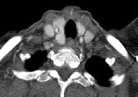 Fig 4.