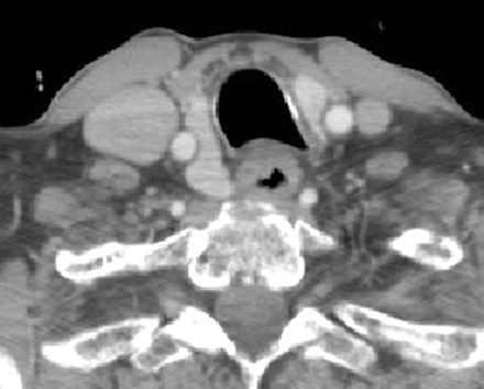 Fig 6.