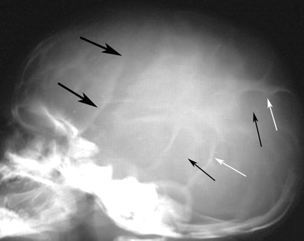 Fig 6.