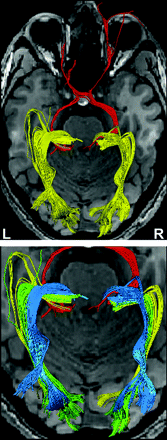 Fig 4.