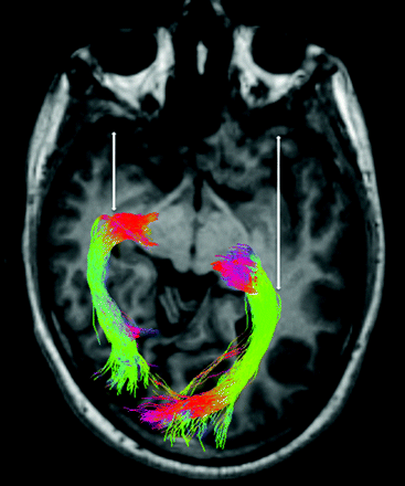 Fig 7.