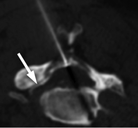 Fig 3.