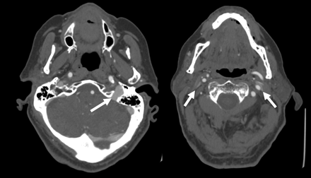 Fig 4.
