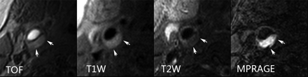 Fig 4.
