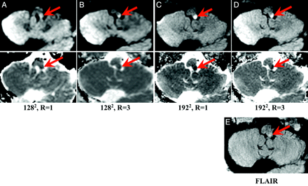 Fig 4.