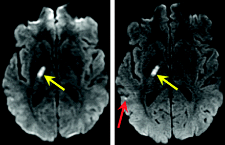 Fig 6.