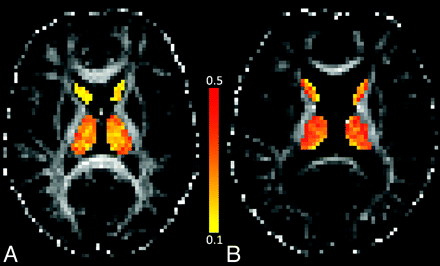 Fig 4.