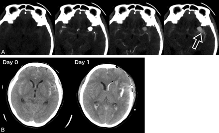 Fig 2.