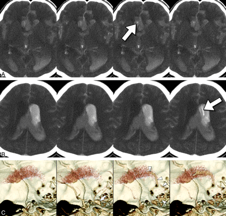 Fig 4.