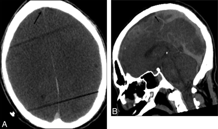 Fig 6.