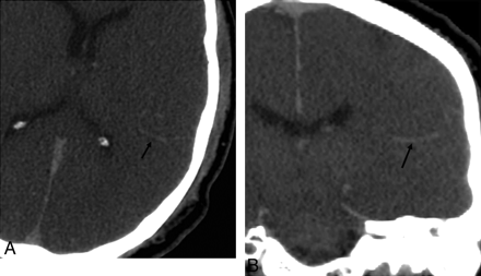 Fig 7.