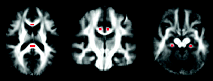 Fig 1.