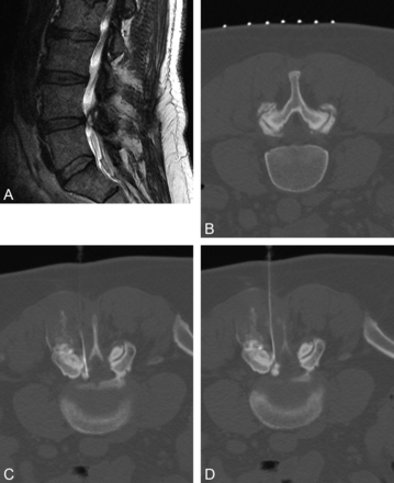 Fig 5.