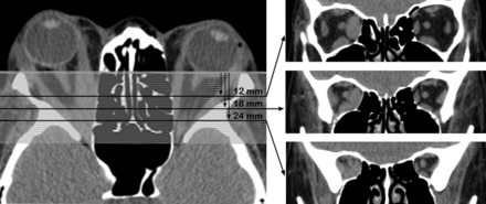Fig 2.