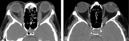 Fig 4.