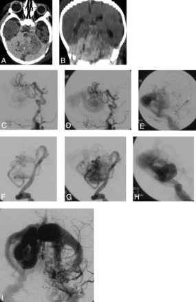 Fig 1.