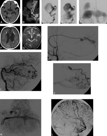 Fig 2.