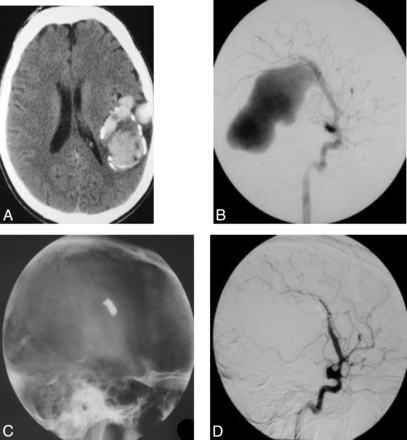 Fig 3.