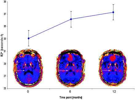 Fig 3.