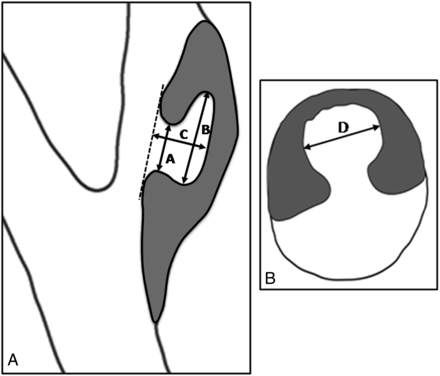 Fig 2.