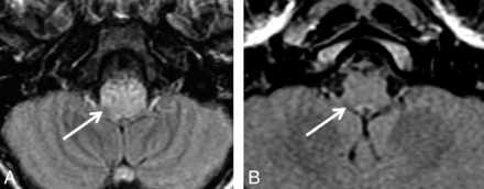 Fig 1.
