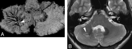 Fig 2.