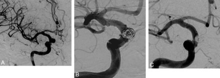 Fig 1.
