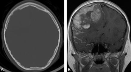 Fig 1.