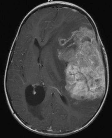 Fig 2.