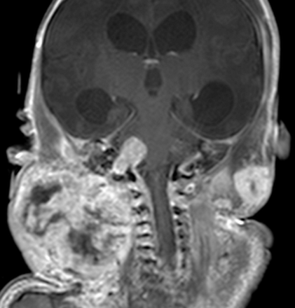 Fig 3.