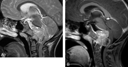 Fig 5.