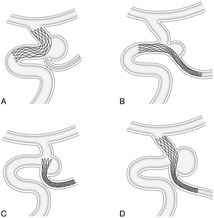 Fig 2.
