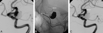Fig 3.