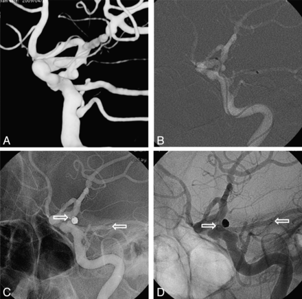 Fig 5.