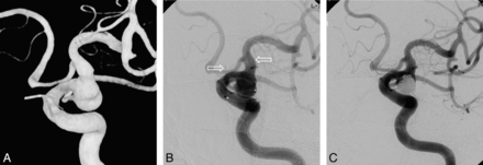 Fig 6.
