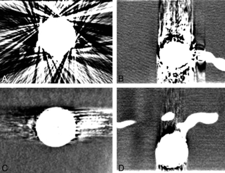 Fig 3.