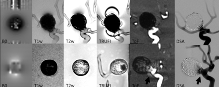Fig 5.