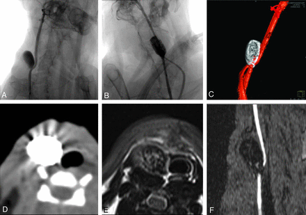 Fig 6.