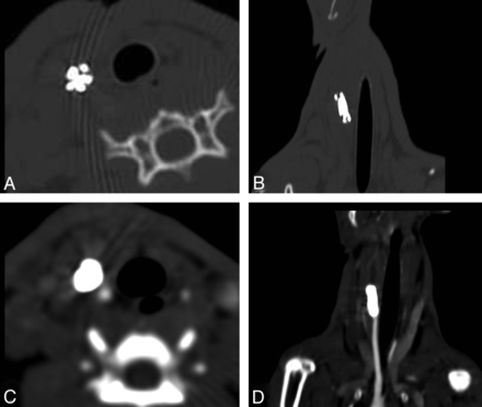 Fig 7.