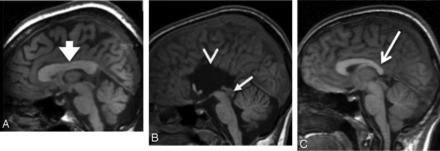 Fig 4.